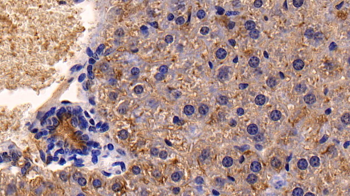 Polyclonal Antibody to Cluster Of Differentiation 26 (CD26)