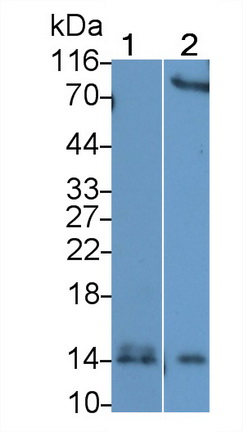 Polyclonal Antibody to Serum Amyloid A (SAA)