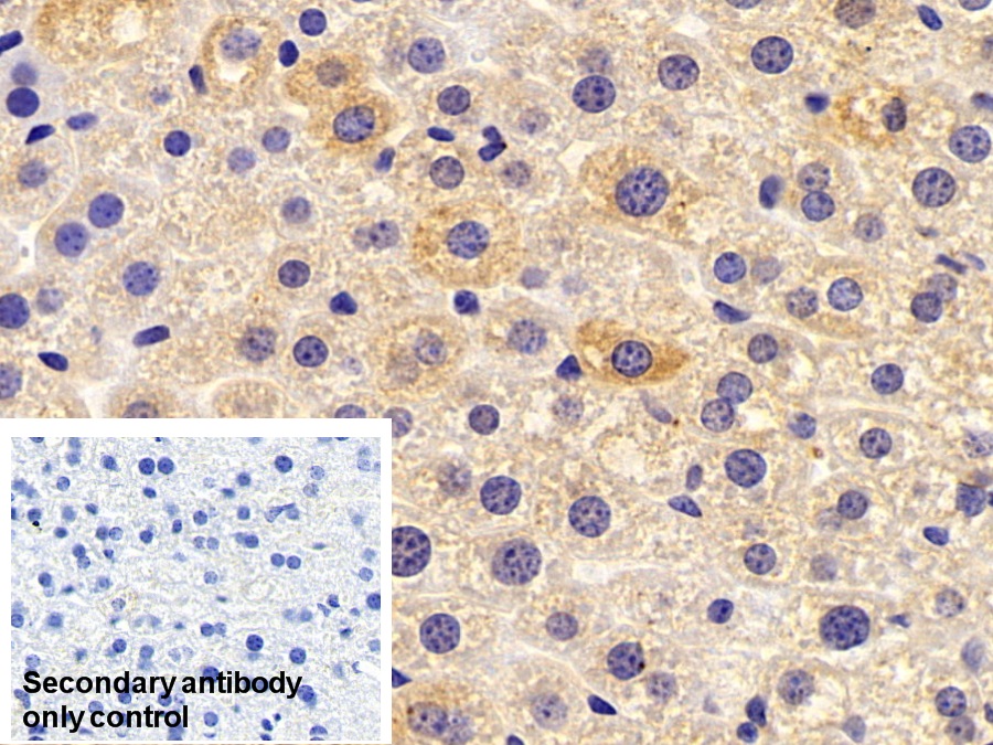 Polyclonal Antibody to Serum Amyloid A (SAA)