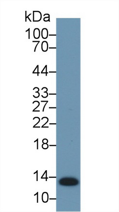 Polyclonal Antibody to Serum Amyloid A (SAA)