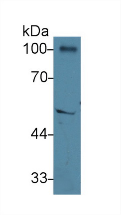 Polyclonal Antibody to Peroxisome Proliferator Activated Receptor Gamma (PPARg)