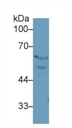 Polyclonal Antibody to Peroxisome Proliferator Activated Receptor Gamma (PPARg)