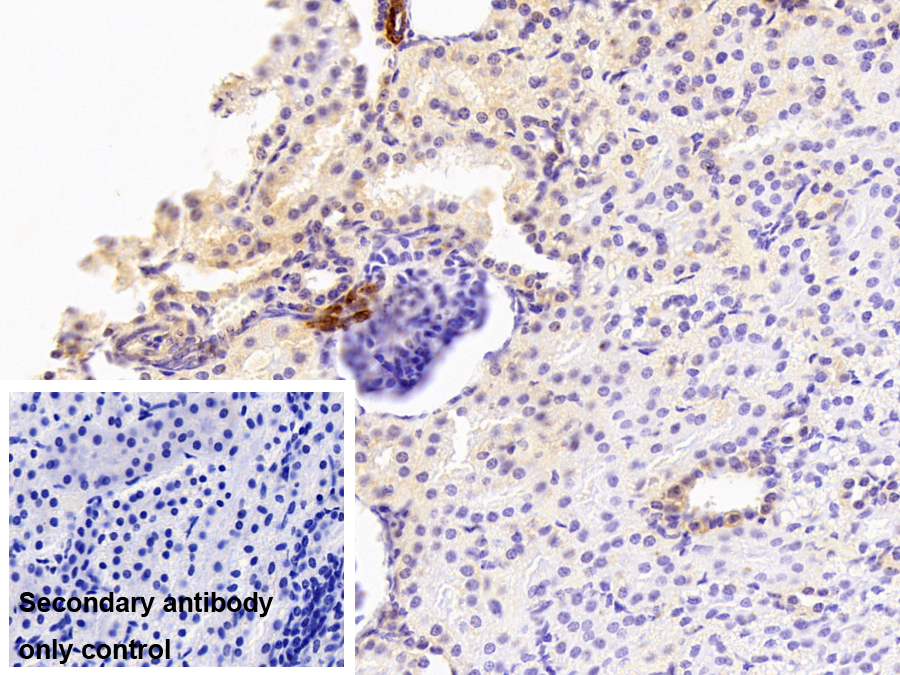 Polyclonal Antibody to Renin (REN)