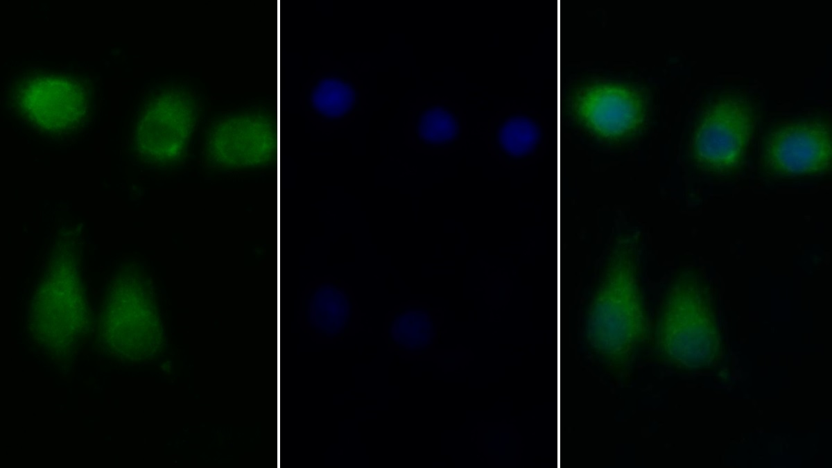 Polyclonal Antibody to Insulin Receptor (INSR)