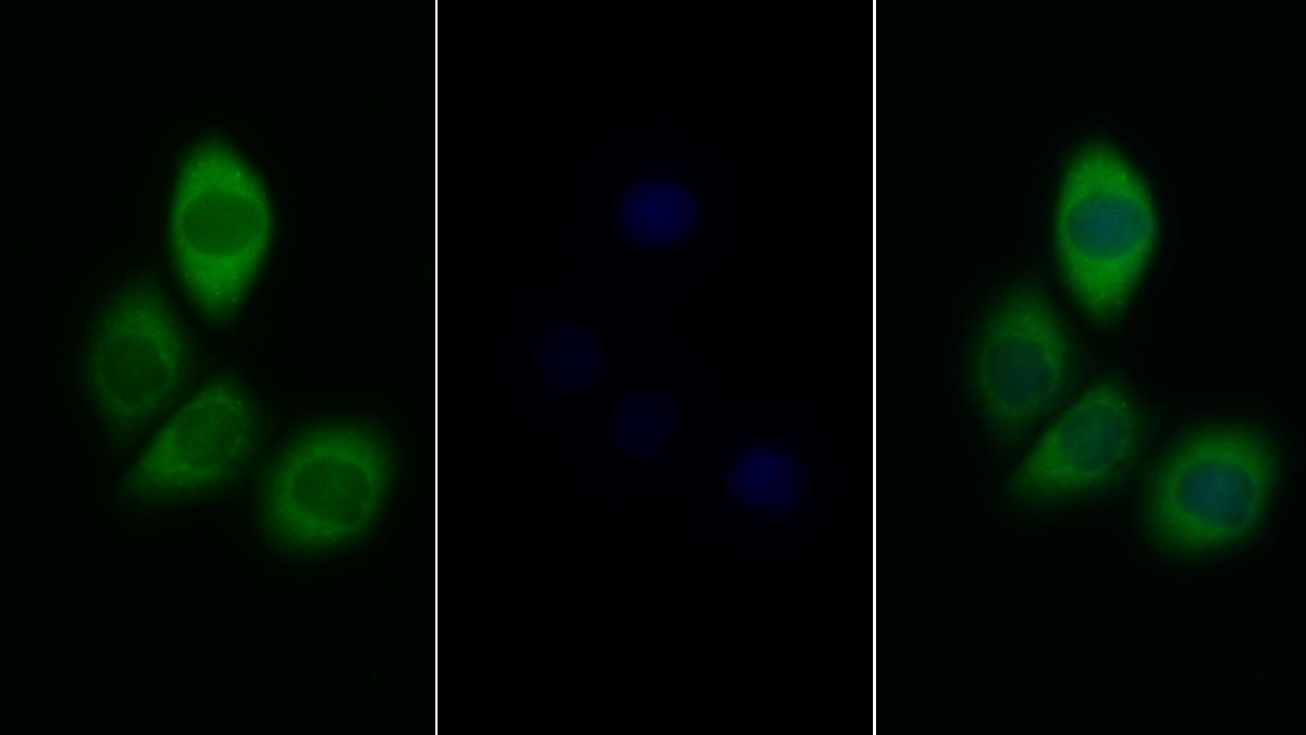 Polyclonal Antibody to Insulin Receptor (INSR)