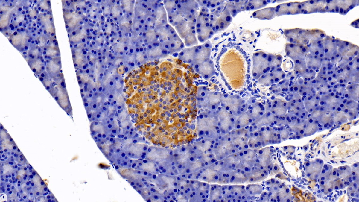 Polyclonal Antibody to Insulin Receptor (INSR)