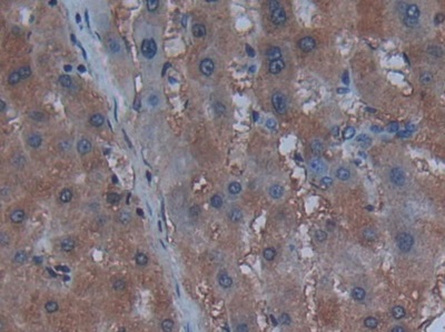 Polyclonal Antibody to Cystatin C (Cys-C)