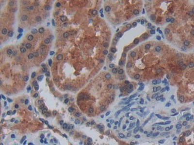 Polyclonal Antibody to Cystatin C (Cys-C)