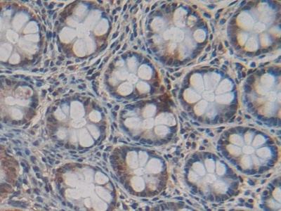 Polyclonal Antibody to Cystatin C (Cys-C)