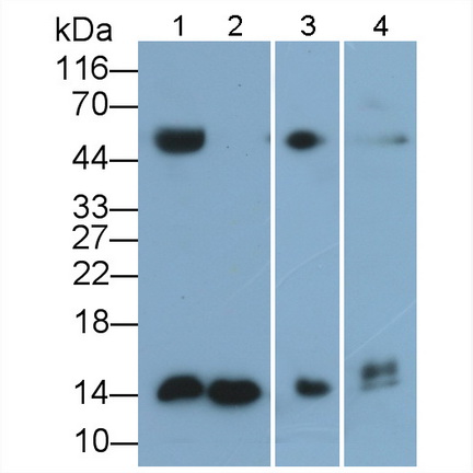 Polyclonal Antibody to Cystatin C (Cys-C)