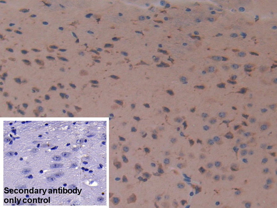 Polyclonal Antibody to Cystatin C (Cys-C)