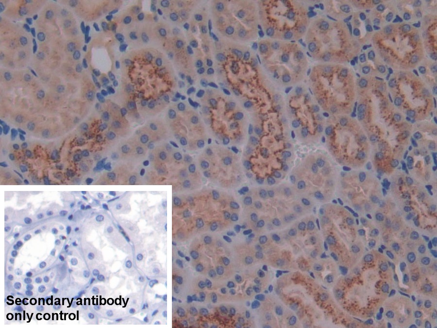 Polyclonal Antibody to Cystatin C (Cys-C)