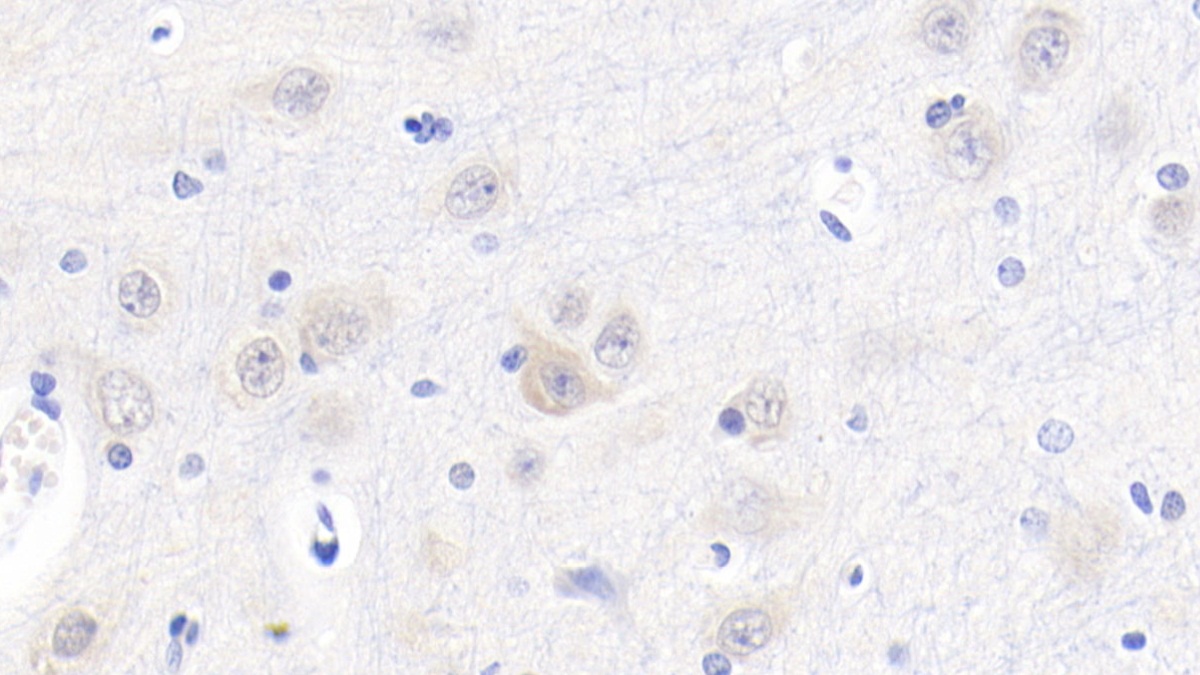 Polyclonal Antibody to Cystatin C (Cys-C)