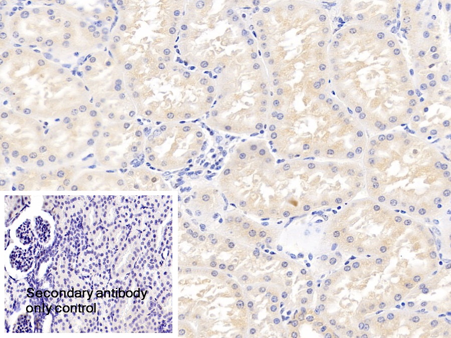 Polyclonal Antibody to Osteopontin (OPN)