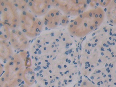 Polyclonal Antibody to Osteopontin (OPN)