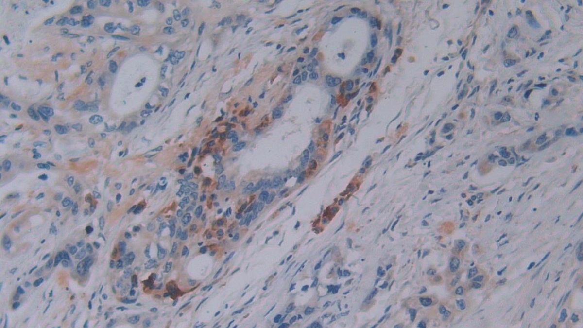 Polyclonal Antibody to Osteopontin (OPN)