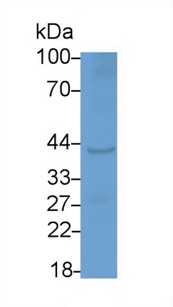 Polyclonal Antibody to Acid Phosphatase 5, Tartrate Resistant (ACP5)