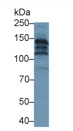 Polyclonal Antibody to Ceruloplasmin (CP)