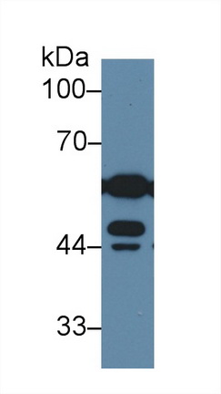 Polyclonal Antibody to Dihydrolipoyl Dehydrogenase (DLD)