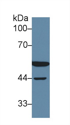 Polyclonal Antibody to Dihydrolipoyl Dehydrogenase (DLD)