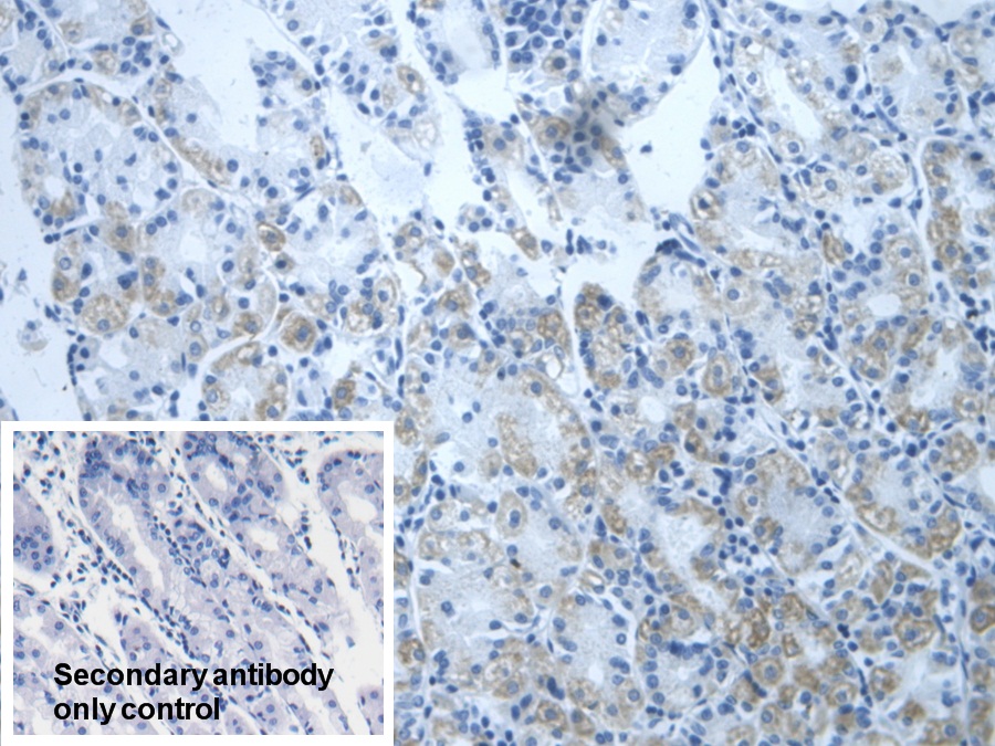 Polyclonal Antibody to Dihydrolipoyl Dehydrogenase (DLD)