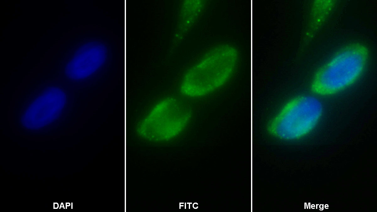 Polyclonal Antibody to Dihydrolipoyl Dehydrogenase (DLD)