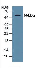 Polyclonal Antibody to Tumor Protein p53 (P53)