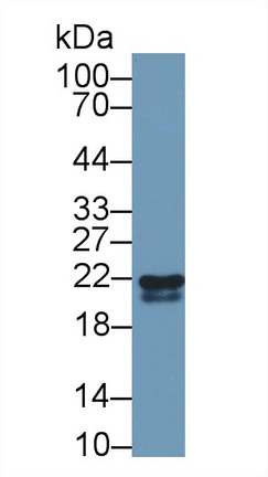 Polyclonal Antibody to Retinol Binding Protein 4 (RBP4)