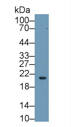 Polyclonal Antibody to Retinol Binding Protein 4 (RBP4)