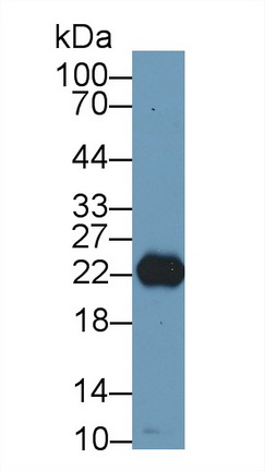 Polyclonal Antibody to Retinol Binding Protein 4 (RBP4)