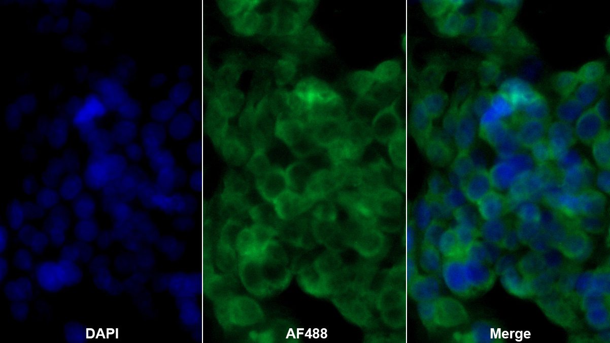 Polyclonal Antibody to Retinol Binding Protein 4 (RBP4)