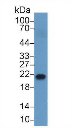 Polyclonal Antibody to Retinol Binding Protein 4 (RBP4)