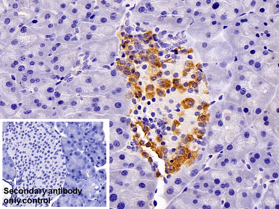 Polyclonal Antibody to Retinol Binding Protein 4 (RBP4)