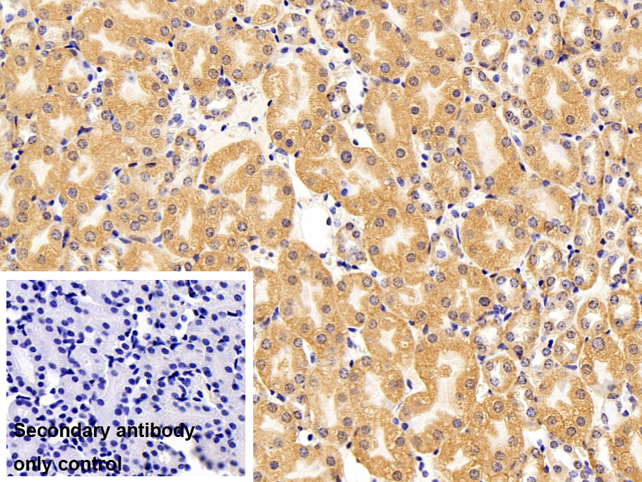 Polyclonal Antibody to Retinol Binding Protein 4 (RBP4)