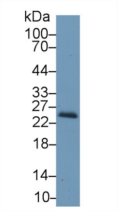 Polyclonal Antibody to Retinol Binding Protein 4 (RBP4)