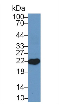 Polyclonal Antibody to Retinol Binding Protein 4 (RBP4)