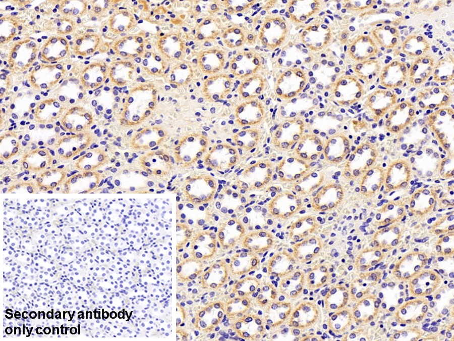 Polyclonal Antibody to Retinol Binding Protein 4 (RBP4)