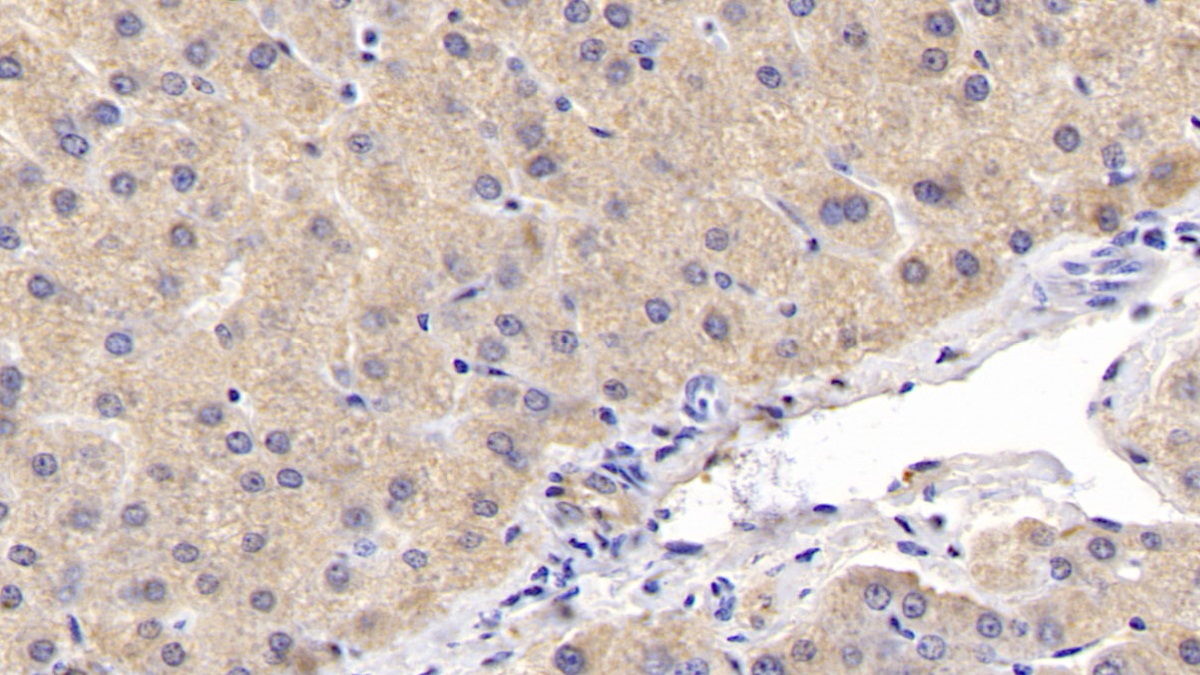 Polyclonal Antibody to Extracellular Signal Regulated Kinase 2 (ERK2)