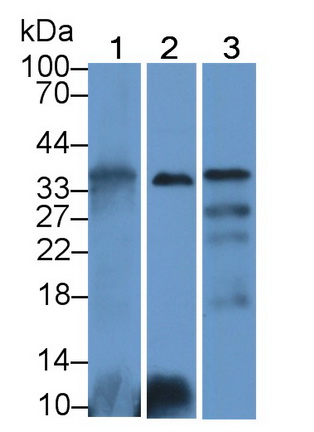 Polyclonal Antibody to Intelectin 1 (ITLN1)