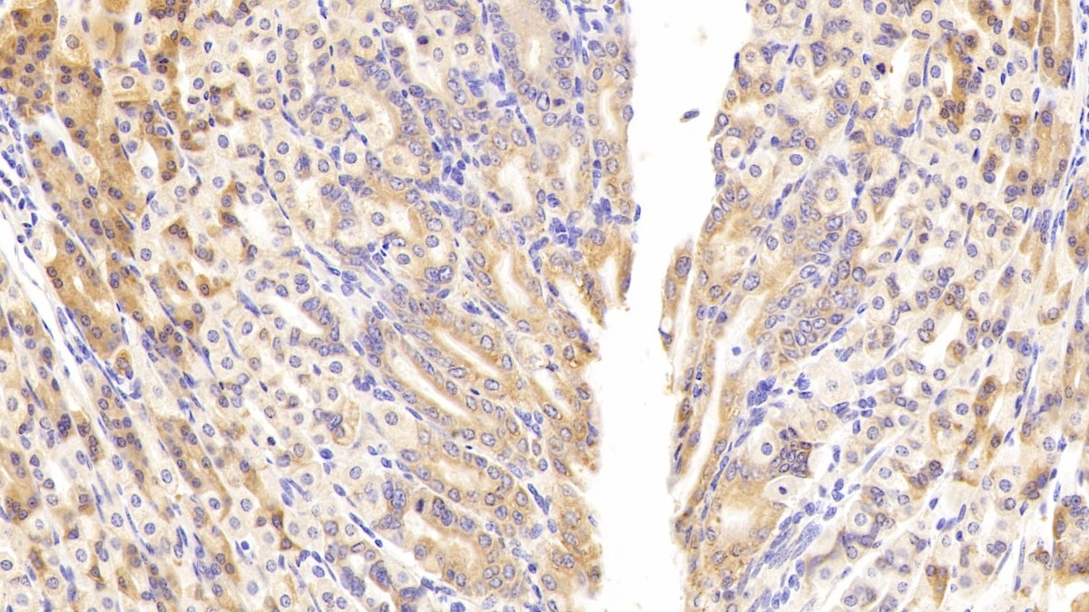 Polyclonal Antibody to Phosphoenolpyruvate Carboxykinase 1, Soluble (PCK1)