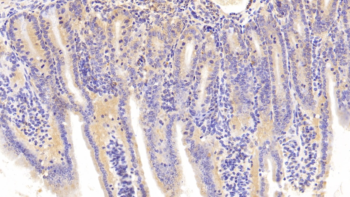 Polyclonal Antibody to Phosphoenolpyruvate Carboxykinase 1, Soluble (PCK1)