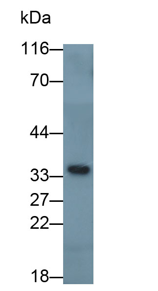 Polyclonal Antibody to Podocin (PDCN)