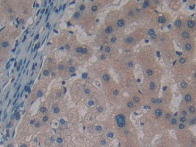 Polyclonal Antibody to Gamma-synuclein (SNCG)