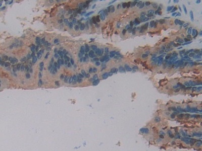 Polyclonal Antibody to Gamma-synuclein (SNCG)