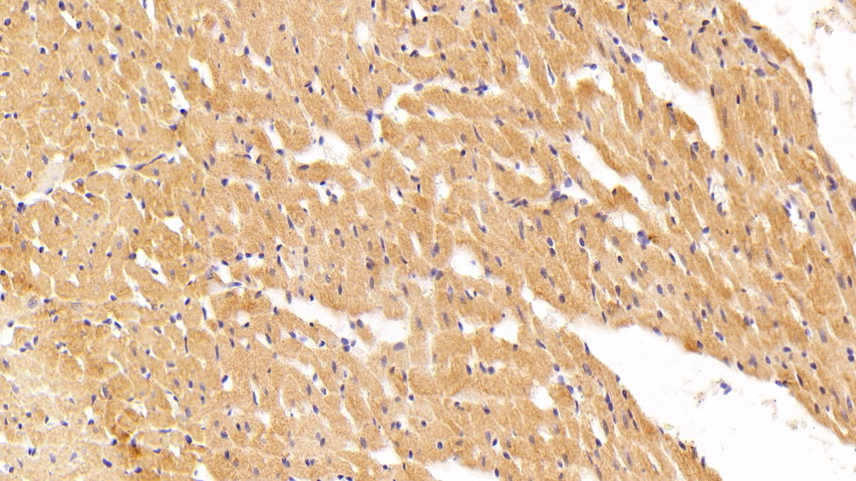 Polyclonal Antibody to Chemokine C-X-C-Motif Receptor 4 (CXCR4)