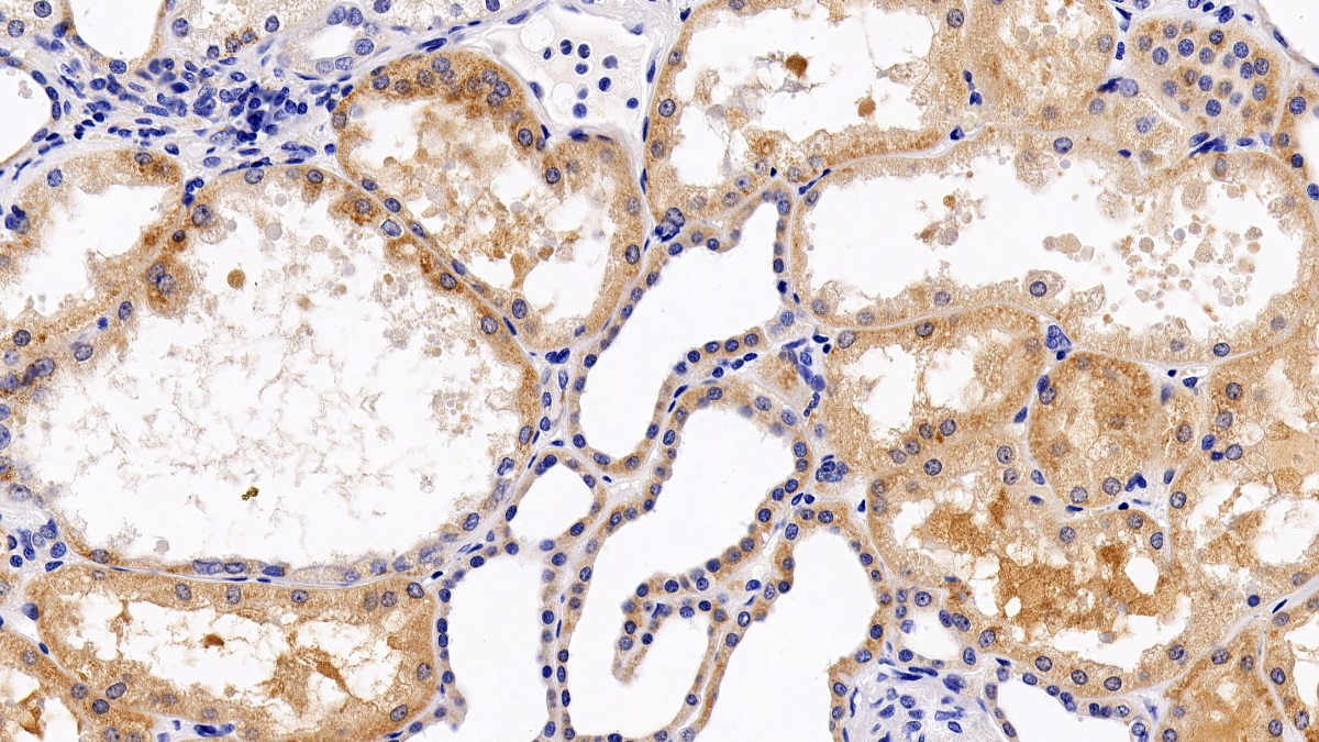 Polyclonal Antibody to Chemokine C-X-C-Motif Receptor 4 (CXCR4)