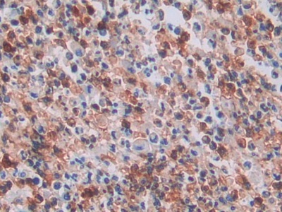 Polyclonal Antibody to Neutrophil Specific Antigen 1 (NB1)