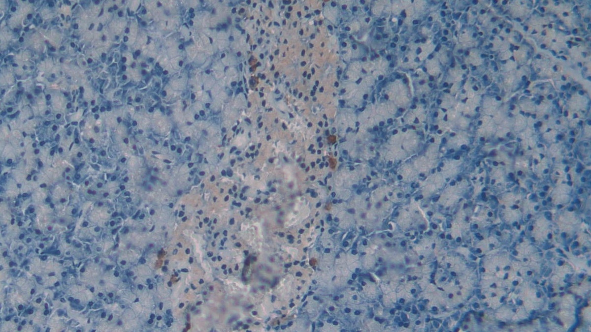 Polyclonal Antibody to Chemerin (CHEM)