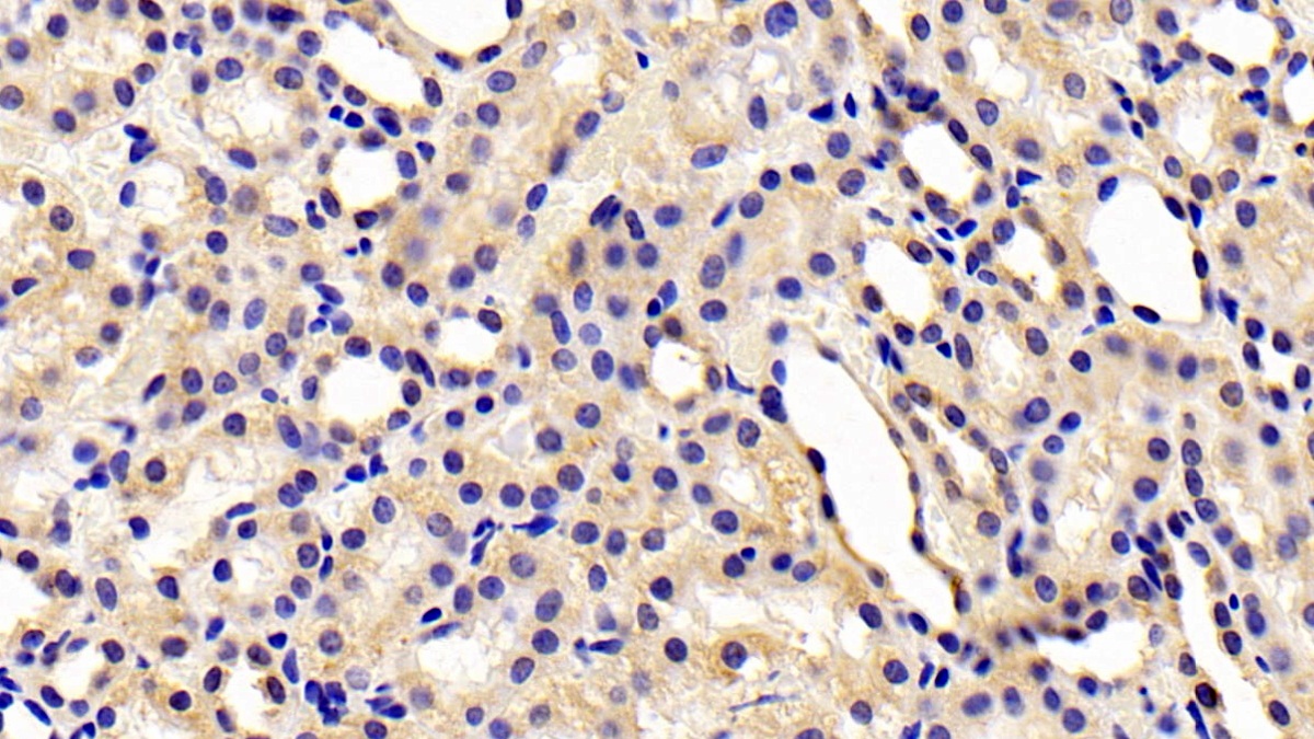 Polyclonal Antibody to Chemerin (CHEM)