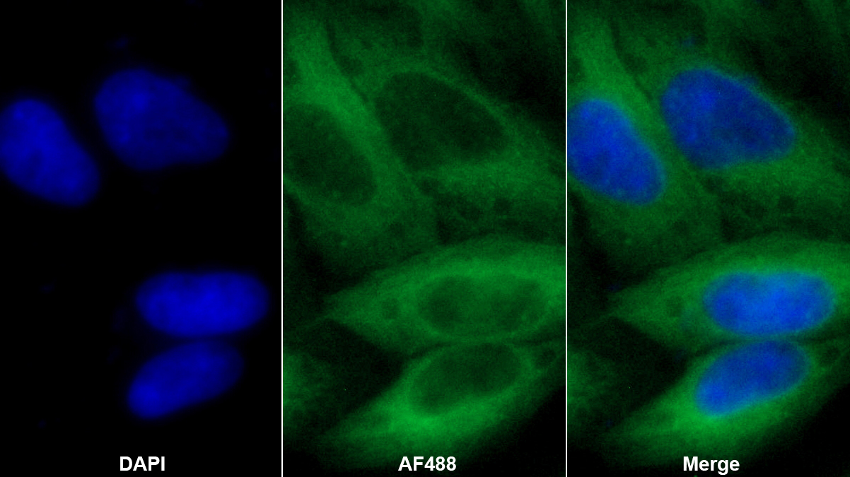 Polyclonal Antibody to Thymidine Phosphorylase (TP)